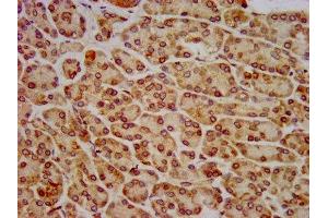 anti-Huntingtin Interacting Protein 1 Related (HIP1R) (AA 304-487) antibody