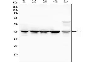 Western blot analysis of MAP2K4 using anti-MAP2K4 antibody (ABIN6719495).