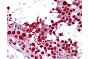 Immunohistochemistry (IHC) image for anti-KH Domain Containing, RNA Binding, Signal Transduction Associated 1 (KHDRBS1) (Middle Region) antibody (ABIN502004) (KHDRBS1 anticorps  (Middle Region))