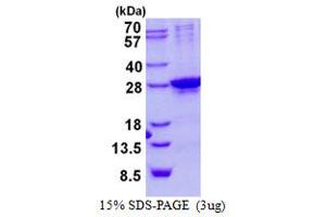 Image no. 1 for SIX Homeobox 6 (SIX6) protein (His tag) (ABIN1098421)