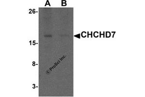 Western Blotting (WB) image for anti-Coiled-Coil-Helix-Coiled-Coil-Helix Domain Containing 7 (CHCHD7) (C-Term) antibody (ABIN1077411) (CHCHD7 anticorps  (C-Term))