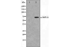 Western blot analysis on HepG2 cell lysate using MMP16 Antibody.