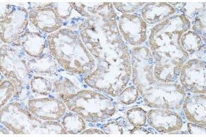 Immunohistochemistry of paraffin-embedded Rat kidney using Snail Polyclonal Antibody at dilution of 1:100 (40x lens).