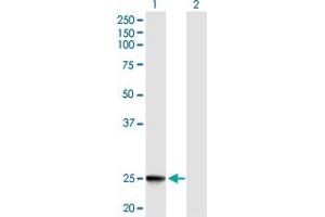 Western Blot analysis of IFNK expression in transfected 293T cell line by IFNK MaxPab polyclonal antibody. (IFNK anticorps  (AA 1-207))