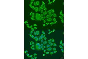 anti-DEXH (Asp-Glu-X-His) Box Polypeptide 58 (DHX58) (AA 389-678) antibody