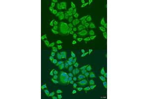 Immunofluorescence analysis of U2OS cells using DHX58 antibody (ABIN6129372, ABIN6139609, ABIN6139610 and ABIN6224272) at dilution of 1:100. (DHX58 anticorps  (AA 389-678))
