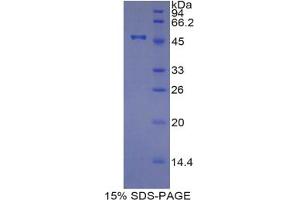 SDS-PAGE analysis of Pig TIMP4 Protein. (TIMP4 Protéine)