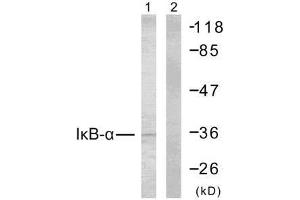 Western blot analysis of extracts from MCF7 cells using IκB-α (Ab-32/36) antibody (E021122). (NFKBIA anticorps)