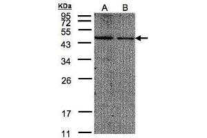 WB Image Sample(30 μg of whole cell lysate) A:293T B:A431, 12% SDS PAGE antibody diluted at 1:200 (EIF4A2 anticorps  (N-Term))