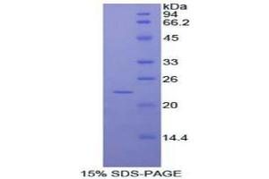 SDS-PAGE (SDS) image for RAD54-Like 2 (RAD54L2) (AA 638-837) protein (His tag) (ABIN2121983) (ARIP4 Protein (AA 638-837) (His tag))