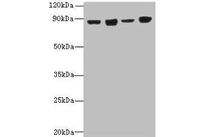 Western blot All lanes: DDX50 antibody at 4 μg/mL Lane 1: Hela whole cell lysate Lane 2: Jurkat whole cell lysate Lane 3: K562 whole cell lysate Lane 4: 293T whole cell lysate Secondary Goat polyclonal to rabbit IgG at 1/10000 dilution Predicted band size: 83 kDa Observed band size: 83 kDa (DDX5 anticorps  (AA 1-210))