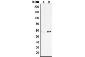 Western blot analysis of Kv3.