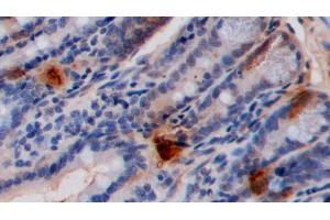 Detection of 5-HT in Mouse Small intestine Tissue using Polyclonal Antibody to 5-Hydroxytryptamine (5-HT) (Serotonin anticorps)