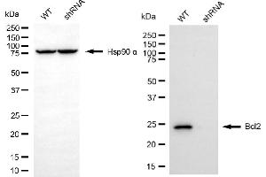 Western blotting analysis using Bcl2 antibody (ABIN7797721).