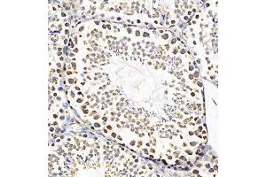 Immunohistochemistry of paraffin embedded mouse testis using PTPN3 (ABIN7075298) at dilution of 1:700 (300x lens) (PTPN3 anticorps)