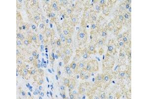 Immunohistochemistry of paraffin-embedded Human liver using SLC19A1 Polyclonal Antibody at dilution of 1:100 (40x lens).