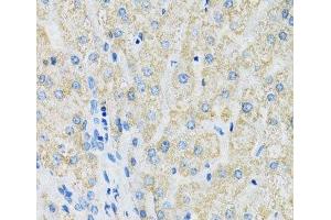 Immunohistochemistry of paraffin-embedded Human liver using SLC19A1 Polyclonal Antibody at dilution of 1:100 (40x lens). (SLC19A1 anticorps)
