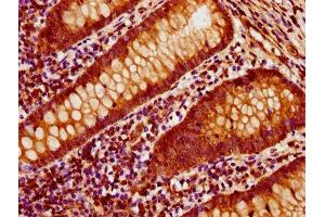 IHC image of ABIN7143136 diluted at 1:500 and staining in paraffin-embedded human appendix tissue performed on a Leica BondTM system.