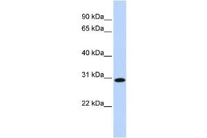 Western Blotting (WB) image for anti-Survival Motor Neuron Domain Containing 1 (SMNDC1) antibody (ABIN2458518) (SMNDC1 anticorps)