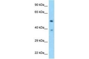 Image no. 1 for anti-tRNA-splicing Endonuclease Subunit SEN2 (TSEN2) (AA 395-444) antibody (ABIN6748165) (TSEN2 anticorps  (AA 395-444))
