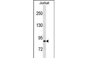 ZN Antibody (C-term) (ABIN1882021 and ABIN2838604) western blot analysis in Jurkat cell line lysates (35 μg/lane). (ZNF337 anticorps  (C-Term))