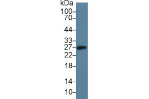 Western Blot; Sample: Mouse Small intestine lysate; Primary Ab: 5µg/ml Rabbit Anti-Mouse CD160 Antibody Second Ab: 0.
