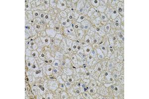Immunohistochemistry of paraffin-embedded human liver injury using NRF1 Antibody (ABIN6290682) at dilution of 1:100 (40x lens). (NRF1 anticorps)
