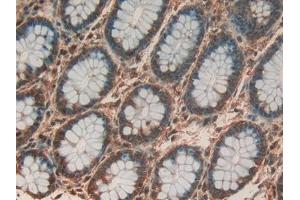 Detection of PHB in Human Rectum Tissue using Polyclonal Antibody to Prohibitin (PHB)