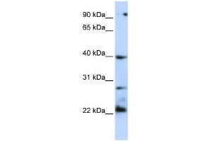 WB Suggested Anti-TNFRSF10B Antibody Titration:  0. (TNFRSF10B anticorps  (N-Term))