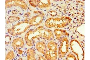 Immunohistochemistry of paraffin-embedded human kidney tissue using ABIN7155729 at dilution of 1:100 (HOXA9 anticorps  (AA 1-190))