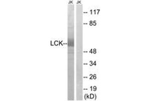 Western blot analysis of extracts from Jurkat cells, using LCK (Ab-59) Antibody. (LCK anticorps  (AA 26-75))
