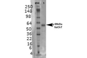 Western Blot analysis of Rat brain membrane lysate showing detection of VAChT protein using Mouse Anti-VAChT Monoclonal Antibody, Clone S6-38 .