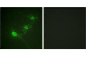 Immunofluorescence analysis of NIH-3T3 cells, using LKB1 (Phospho-Ser428) Antibody. (LKB1 anticorps  (pSer428))