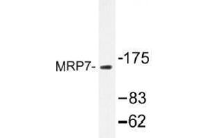 Image no. 1 for anti-ATP-Binding Cassette, Sub-Family C (CFTR/MRP), Member 10 (ABCC10) antibody (ABIN317845) (ABCC10 anticorps)