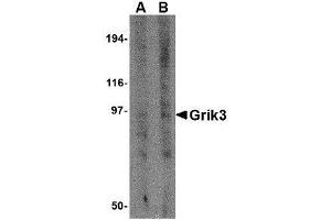 Image no. 1 for anti-Glutamate Receptor, Ionotropic, Kainate 3 (GRIK3) (N-Term) antibody (ABIN1494385) (GRIK3 anticorps  (N-Term))