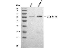 anti-Solute Carrier Family 6, Member 18 (SLC6A18) (AA 1-569) antibody