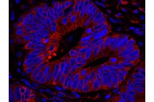 Immunofluorescence (IF) image for anti-Reticulocalbin 1, EF-Hand Calcium Binding Domain (RCN1) (AA 1-75) antibody (ABIN7449011) (RCN1 anticorps  (AA 1-75))