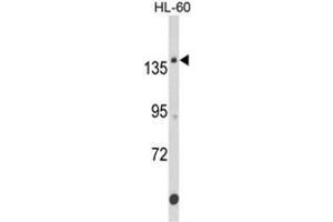 Western blot analysis of FNDC3B Antibody (N-term) in HL-60 cell line lysates (35ug/lane). (FNDC3B anticorps  (N-Term))