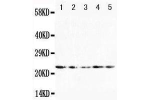 Anti-FGF10 antibody, Western blotting Lane 1: U87 Cell Lysate Lane 2: HELA Cell Lysate Lane 3: A519 Cell Lysate Lane 4: 293T Cell Lysate Lane 5: HELA Cell Lysate (FGF10 anticorps  (N-Term))