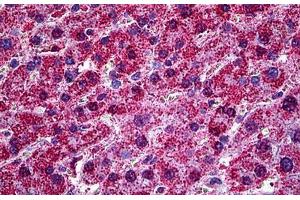 Human Liver: Formalin-Fixed, Paraffin-Embedded (FFPE)