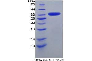 SDS-PAGE analysis of Mouse LRP1 Protein.