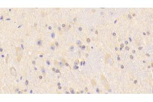 Detection of CARNS1 in Mouse Cerebrum Tissue using Polyclonal Antibody to Carnosine Synthase 1 (CARNS1) (CARNS1 anticorps  (AA 623-826))