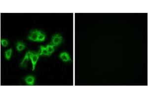 Immunofluorescence analysis of HeLa cells, using CDON Antibody.