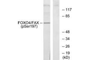 Western blot analysis of extracts from 293 cells treated with serum, using AFX (Phospho-Ser197) Antibody. (FOXO4 anticorps  (pSer197))