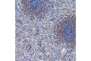 IHC analysis of SETD3 using anti-SETD3 antibody (ABIN7600293). (SETD3 anticorps  (AA 173-468))