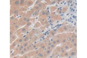 Used in DAB staining on fromalin fixed paraffin- embedded Kidney tissue (PRKD3 anticorps  (AA 576-832))