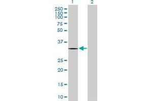 Western Blot analysis of ZNF511 expression in transfected 293T cell line by ZNF511 MaxPab polyclonal antibody. (ZNF511 anticorps  (AA 1-252))