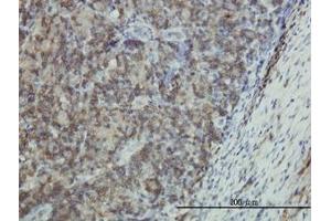 Image no. 1 for anti-Epithelial Membrane Protein 3 (EMP3) (AA 1-164) antibody (ABIN598660) (EMP3 anticorps  (AA 1-164))