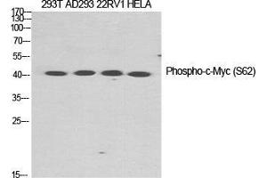 Western Blot (WB) analysis of specific cells using Phospho-c-Myc (S62) Polyclonal Antibody. (c-MYC anticorps  (pSer62))