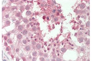 Rabbit Anti-PSMA6 antibody  Formalin Fixed Paraffin Embedded Tissue: Human Testis Primary antibody Concentration: 1:100 Secondary Antibody: Donkey anti-Rabbit-Cy3 Secondary Antibody Concentration: 1:200 Magnification: 20x Exposure Time: 0.